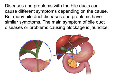 bile leakage symptoms|Draining blocked bile ducts